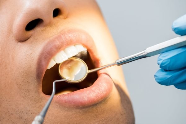 cropped view of african american man with open mouth during checkup